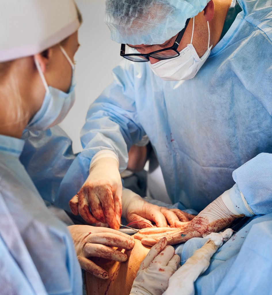 why is laparoscopic surgery done​