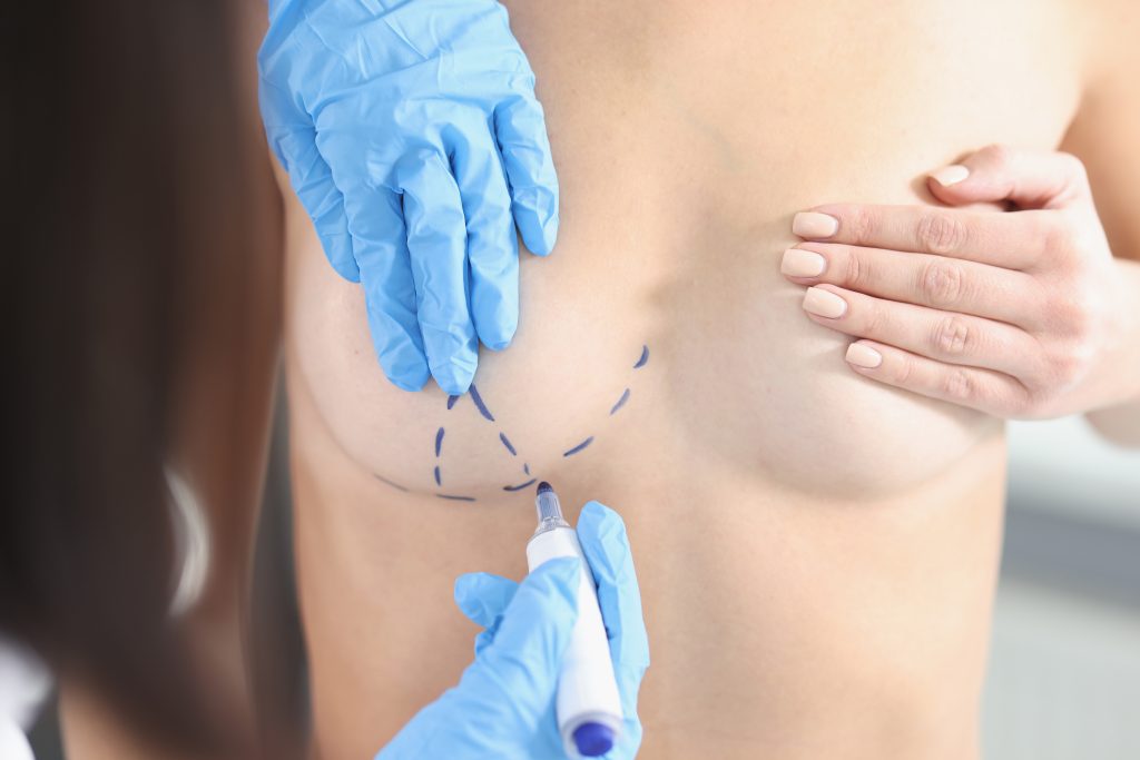 Woman consulting breast surgery specialist at Sai Vedant Hospital Pune for augmentation, reduction or reconstruction