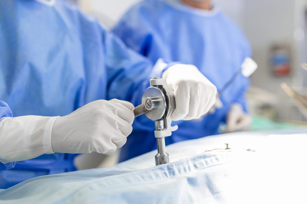 Arthroscopy Surgery