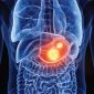 Gastrointestinal_1 85x85