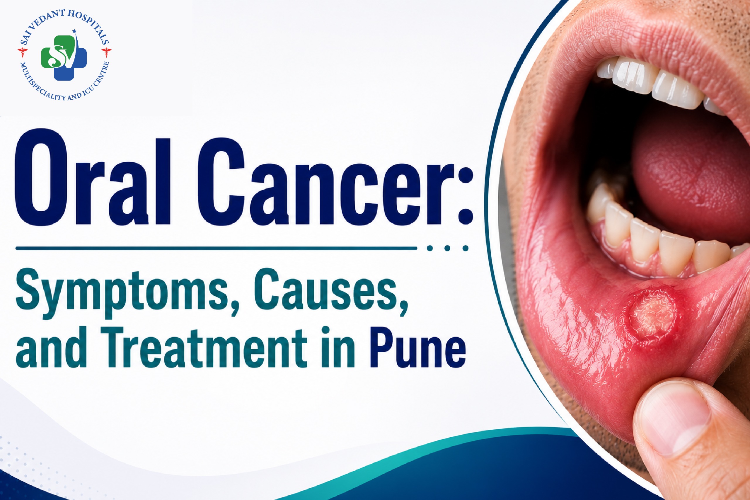 Oral Cancer: Symptoms, Causes, and Treatment in Pune